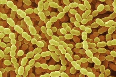 Streptococcus thermophilus